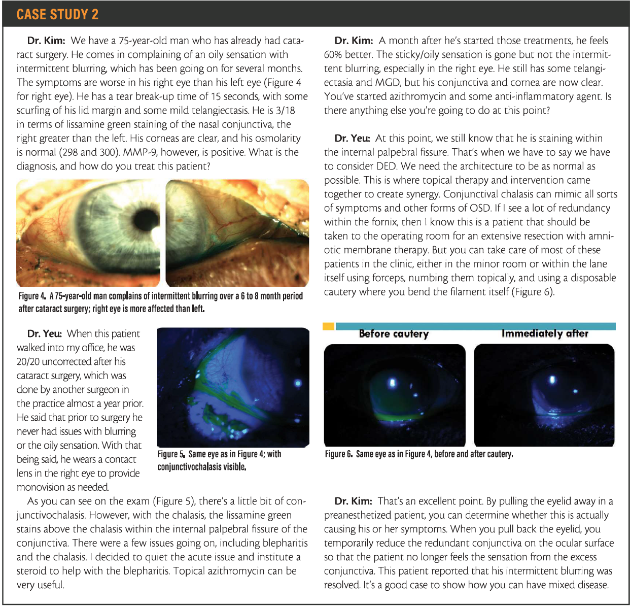 Evolve Medical Education | Dry Eye Management Strategies: Appropriate ...